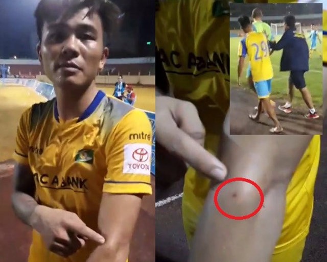 V.League tái hiện vụ Suarez cắn tay Ivanovic - ảnh 1