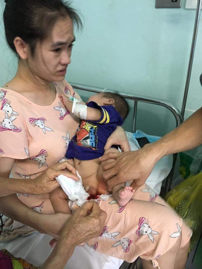 Vợ chồng tật nguyền nuôi con 6 tháng tuổi mắc bệnh hiểm nghèo - ảnh 1