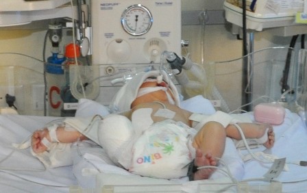 Đau đớn tháo khớp gối bé sơ sinh gặp tai nạn thảm khốc - ảnh 1