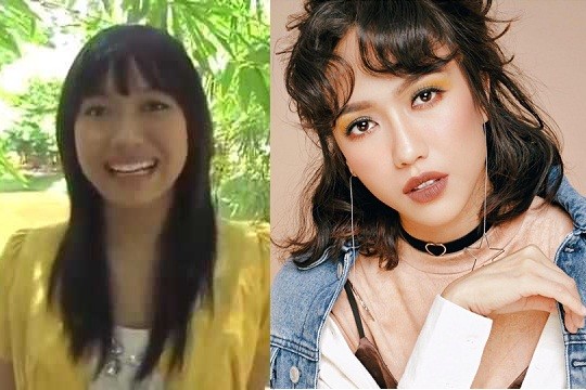 Loạt cây hài Việt vướng nghi án ‘dao kéo’ - ảnh 4