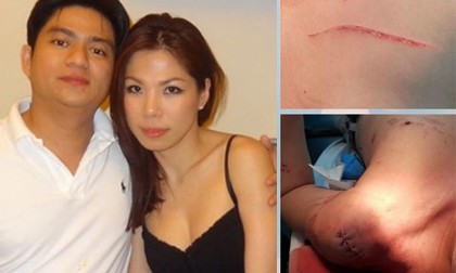 Dời ngày xử nhóm người chém bác sĩ Chiêm Quốc Thái - ảnh 1