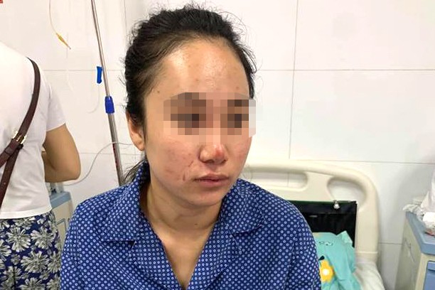 Vụ cô gái bị đánh dã man ở Hà Nội: Nghi do dàn dựng vụ đánh ghen? - ảnh 1