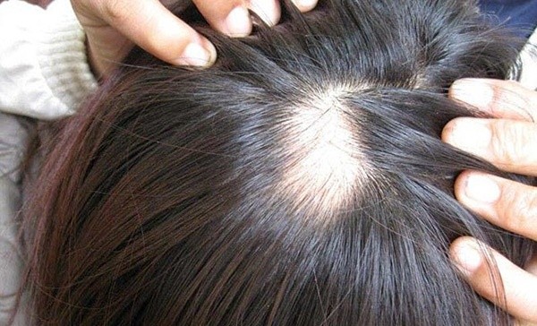 5 thói quen tưởng vô hại mà cực kỳ nguy hiểm cần tránh - ảnh 3