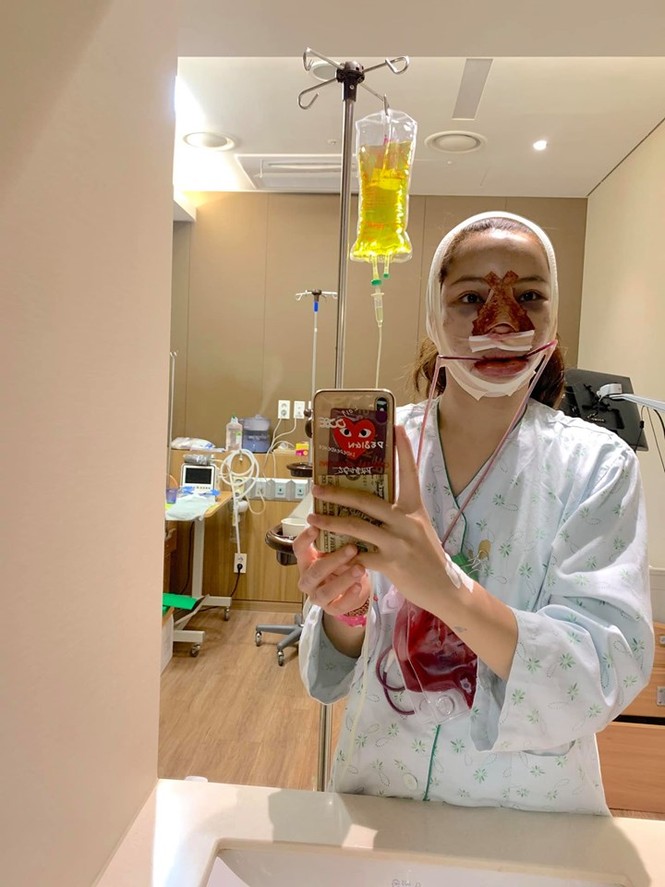 Lưu Đê Ly tung ảnh phẫu thuật biến dạng, công khai 'đập mặt' níu kéo tuổi xuân - ảnh 1