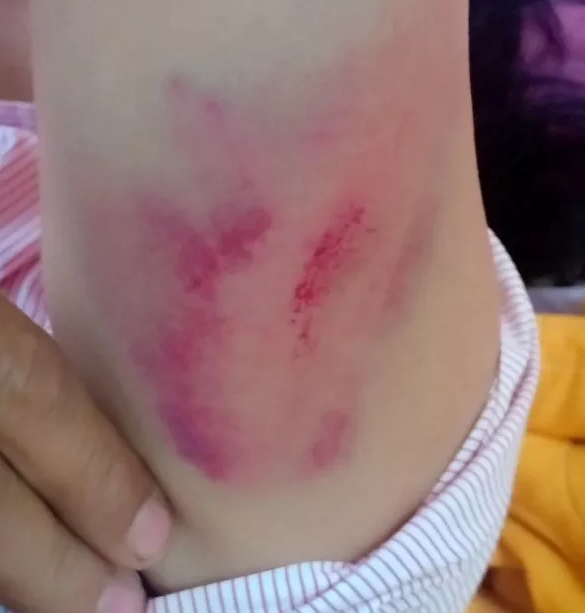 Chánh văn phòng Huyện ủy đánh tài xế nhập viện - ảnh 1