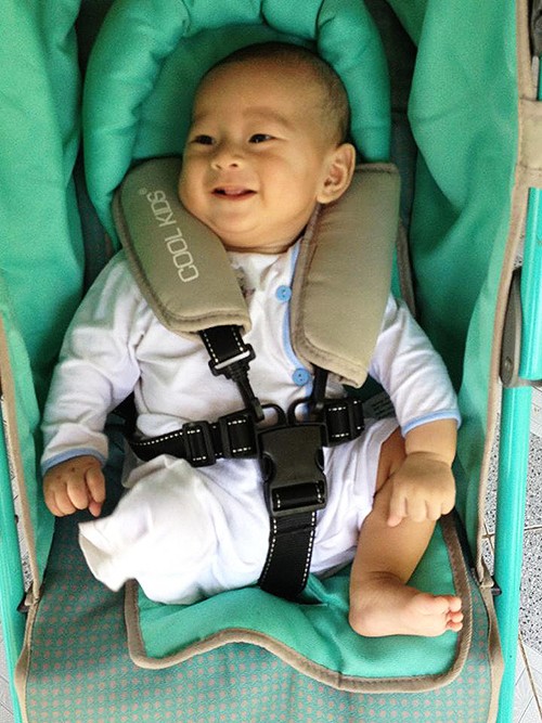 Gian nan tạo chân giả cho bé trai bị văng khỏi bụng mẹ - ảnh 1