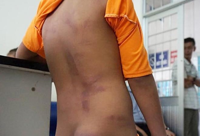 4 học sinh tiểu học bị người nhà đánh và xát muối ớt vào vết thương - ảnh 1
