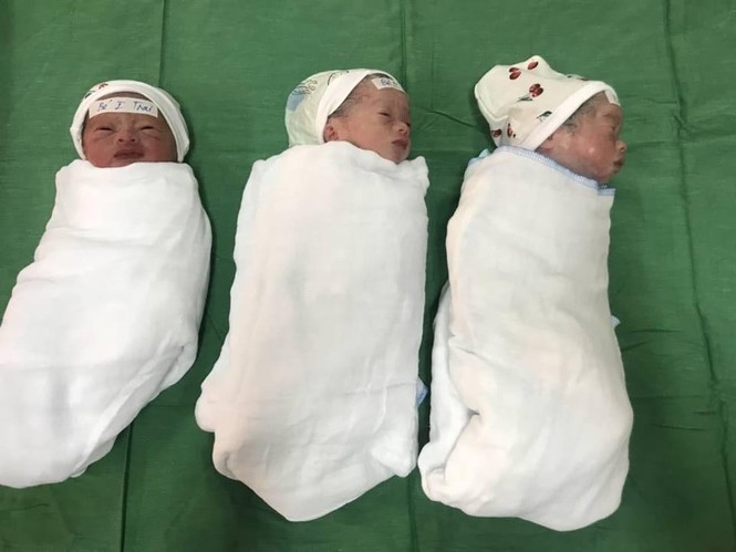 Nghệ An: Đỡ đẻ thành công cho sản phụ 23 tuổi sinh 3 hiếm gặp - ảnh 2