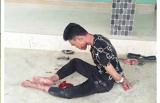 Nghi án chồng giết vợ rồi tự tử trong căn phòng khóa trái cửa - ảnh 1