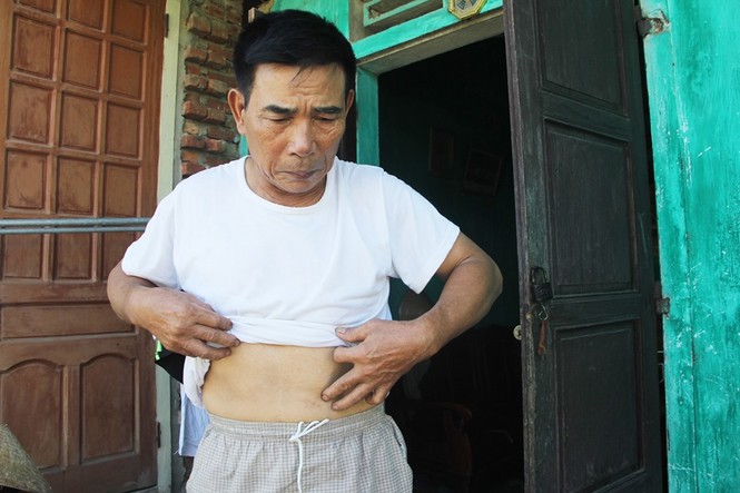 Nghệ An: Khôi phục, truy lĩnh chế độ cho 30 thương binh thật - ảnh 1