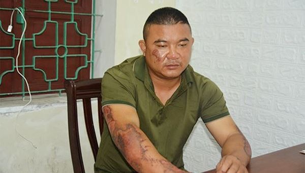 Mâu thuẫn tình cảm, người đàn ông tưới xăng đốt nhà khiến 5 người nhập viện - ảnh 3
