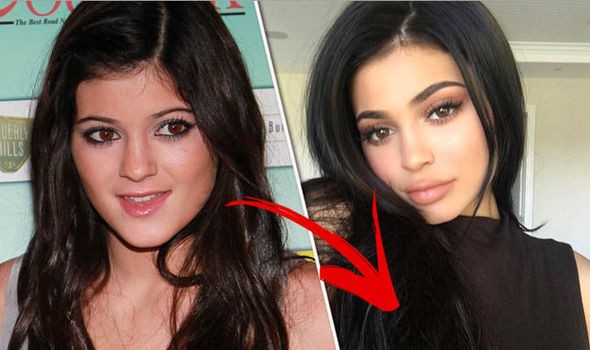 ‘Hot girl môi tều’ nhà Kardashian vẫn quyến rũ dù bỏ filler bơm môi - ảnh 2