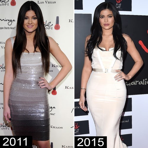 ‘Hot girl môi tều’ nhà Kardashian vẫn quyến rũ dù bỏ filler bơm môi - ảnh 3
