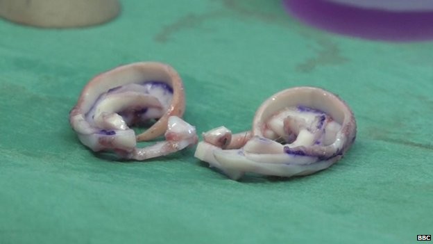 Ghép tai làm từ sụn người cho cậu bé 9 tuổi - ảnh 1