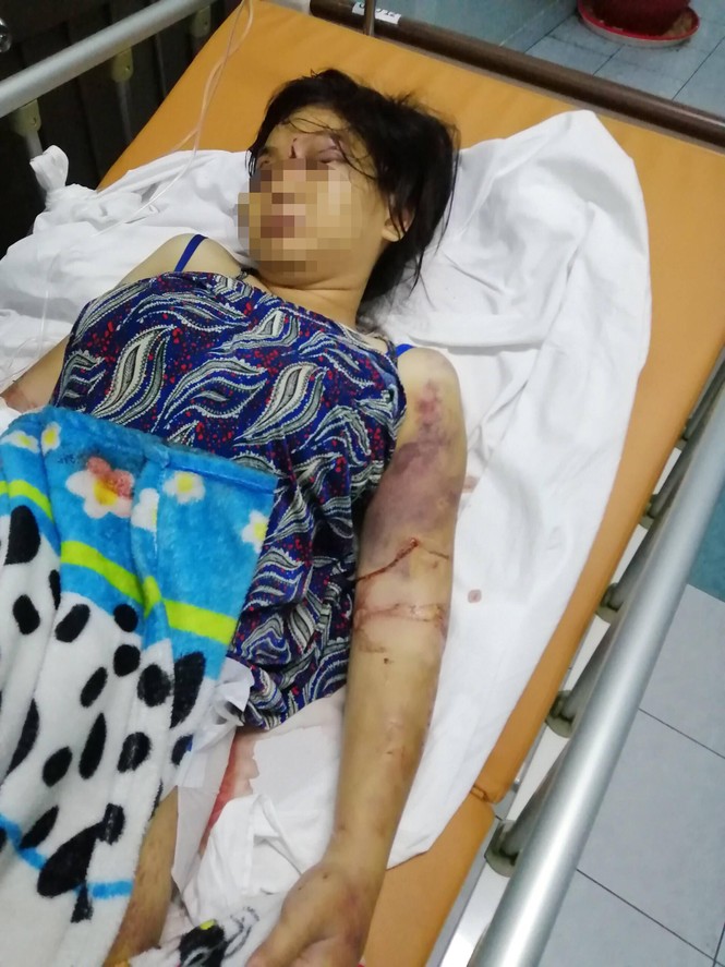 Vụ cô gái 18 tuổi bị tra tấn đến sẩy thai: Bắt tạm giam một đối tượng - ảnh 1