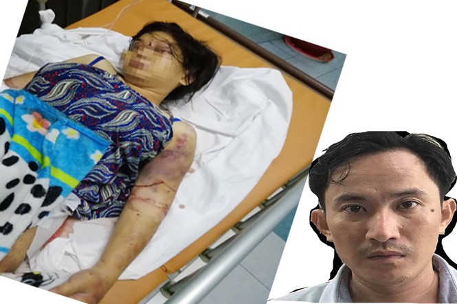 Lời khai bất ngờ của 3 nghi phạm tra tấn cô gái dã man như thời trung cổ - ảnh 1