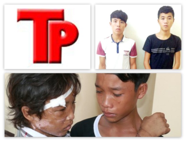 Bản tin Hình sự 18H: Bị hiếp dâm tập thể, cô gái 18 tuổi hôn mê sâu - ảnh 1