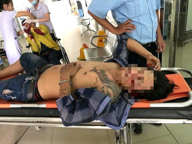 Bị tấn công, bảo vệ móc súng bắn như phim hành động - ảnh 1