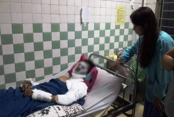 Vụ tạt a xít ở Quảng Ngãi: Bộ Công an đã vào cuộc tiến hành điều tra - ảnh 4