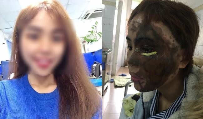Cựu thiếu úy công an lên kế hoạch, mua can axit 30 lít để tạt vợ sắp cưới - ảnh 1