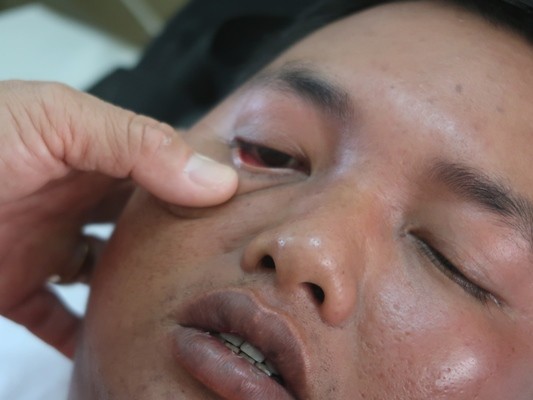 Dịch sốt xuất huyết tại TPHCM vẫn cao dù đang ở chu kỳ giảm - ảnh 4