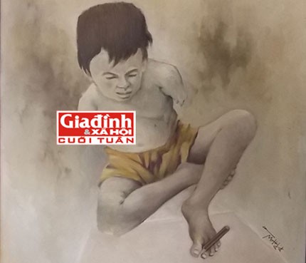 Cuộc sống trường thọ của người đàn ông có tim nằm bên phải - ảnh 1