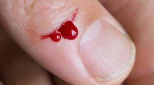 Tránh xa gừng nếu bạn mắc các bệnh sau kẻo ‘hối không kịp’ - ảnh 1