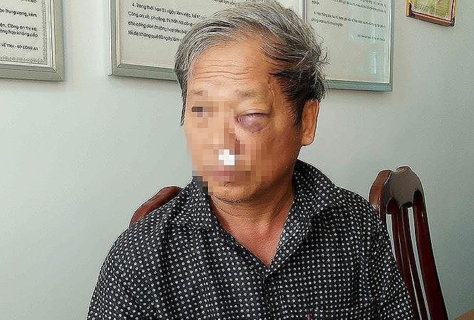 Mới nhất vụ phóng viên VTV bị đánh dã man - ảnh 1