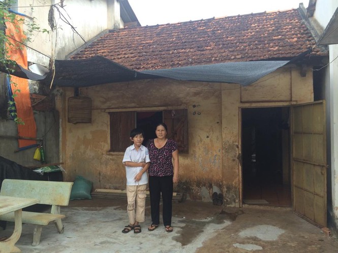 Cậu bé “Trư Bát Giới” và gần chục lần lên bàn mổ - ảnh 4