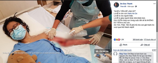 Xót xa con gái đạo diễn Đỗ Đức Thành phải mổ đi cánh tay - ảnh 1