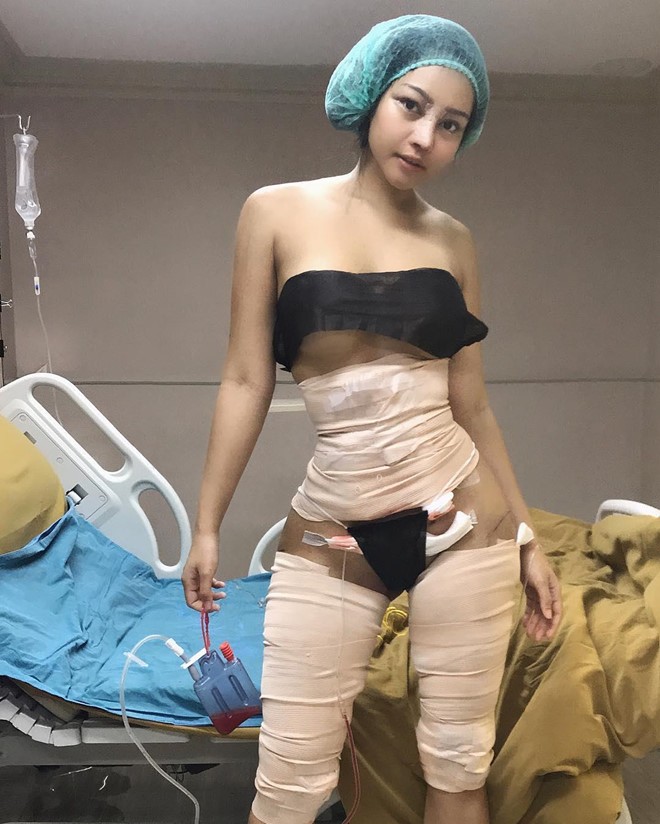 Hành trình bất chấp mọi rủi ro để có vòng eo 46 cm của cô gái Thái - ảnh 3