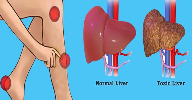 Làm tốt 5 việc này ít khi mắc bệnh gan: Thải độc, tăng khí huyết, ngừa bệnh - ảnh 1