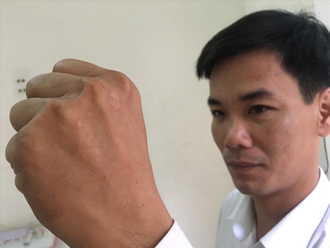 Khóc cười sau đường dây nóng 'bắt' ăn xin - ảnh 1
