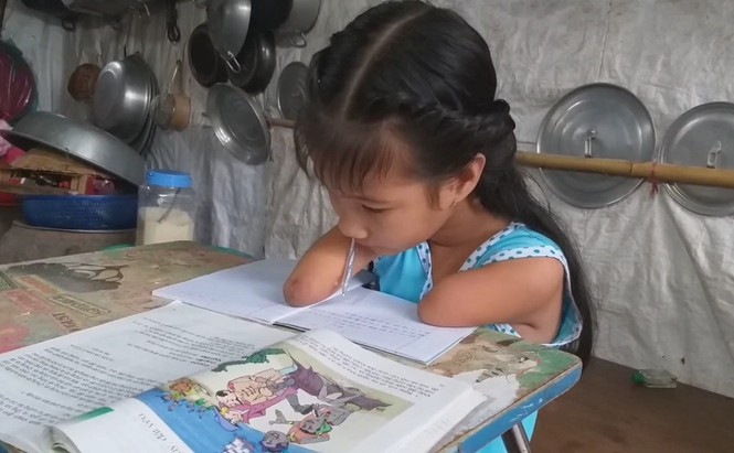 Nghị lực phi thường của cô bé khiếm khuyết tay chân - ảnh 1