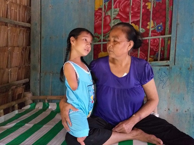 Nghị lực phi thường của cô bé khiếm khuyết tay chân - ảnh 3