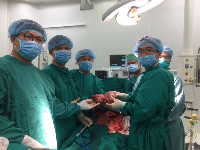 Mang khối u 3kg suốt 5 năm, nam bệnh nhân được phẫu thuật thành công - ảnh 1