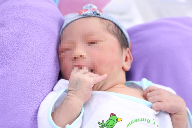Cứu được bé sơ sinh hoại tử gần hết dây rốn từ trong bụng mẹ - ảnh 1