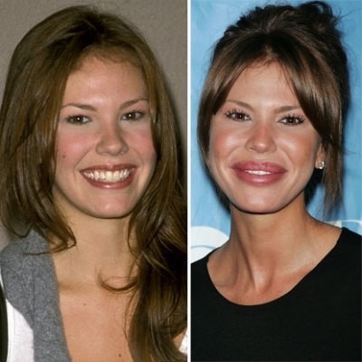Nikki Cox - nữ diễn viên truyền hình của Mỹ. Cô từ nhỏ đã bắt đầu đi diễn, múa ba lê và toả sáng với hàng loạt phim truyền hình nổi tiếng: Star Strek, The Next Generation, Blossom... Không chỉ chinh phục khán giả bằng tài năng, gương mặt xinh đẹp của Cox cũng khiến nhiều người ngưỡng mộ. Tuy nhiên, do lạm dụng phẫu thuật thẩm mỹ, gương mặt xinh đẹp ngày nào đã bị biến dạng, xấu đi trông thấy