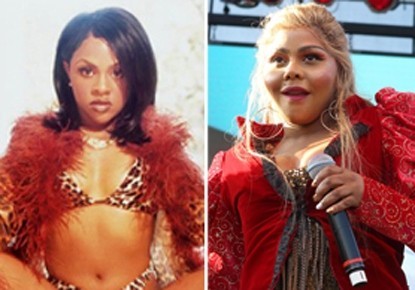 Nữ rapper Lil Kim đã vài lần dùng đến công nghệ phẫu thuật thẩm mỹ để nâng cao nhan sắc, cô nâng mũi, nâng má. Hiện nay, gương mặt cô bị sưng phù và không thể nhận ra cô ca sĩ gợi cảm ngày nào
