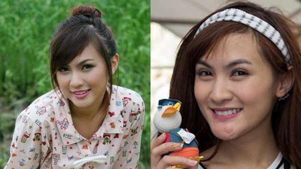 Kelly Tú Anh là một girl có tiếng ở Đà Lạt những năm 2007 -2008, sau khi Nam Tiến và đạt được một số thứ hạng cao ở các cuộc thi sắc đẹp dành cho tuổi teen, Kelly bắt đầu được giới trẻ chú ý đến trên danh nghĩa của một hot girl. Tuy nhiên, càng về sau, sự xuất hiện của cô trong lòng giới trẻ ngày một nhạt nhòa. Mãi đến tháng 8/2011, Kelly bất ngờ xuất hiện trong một sự kiện dành cho giới trẻ tại TP.HCM với chiếc cằm bị méo. Hình ảnh cho thấy sự khác biệt của Kelly trước và sau khi nhờ