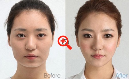Phẫu thuật thẩm mỹ phổ biến nhất tại Hàn Quốc là gọt cằm và thay đổi mí mắt, từ một sang hai mí.