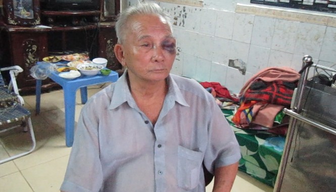 Ba người dân bị côn đồ đâm chém loạn xạ - ảnh 2