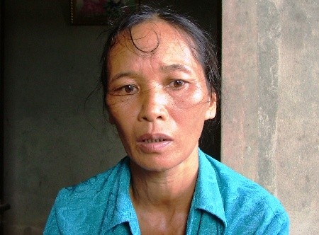 Mắc bệnh lạ, chàng sinh viên quanh năm chỉ... húp cháo - ảnh 4