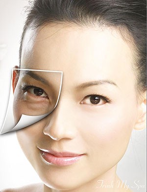 Nhìn mắt bắt bệnh - ảnh 1