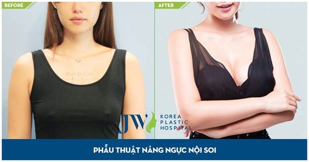 Cơ hội làm đẹp vòng 1 miễn phí với chuyên gia Hàn Quốc - ảnh 2