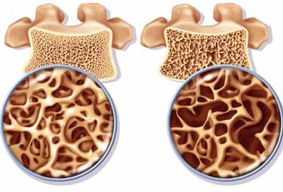 Thuốc lá gây ra những bệnh gì? - ảnh 3