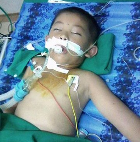 Bị đàn ong tấn công, cháu bé nhập viện trong tình trạng nguy kịch. - ảnh 1