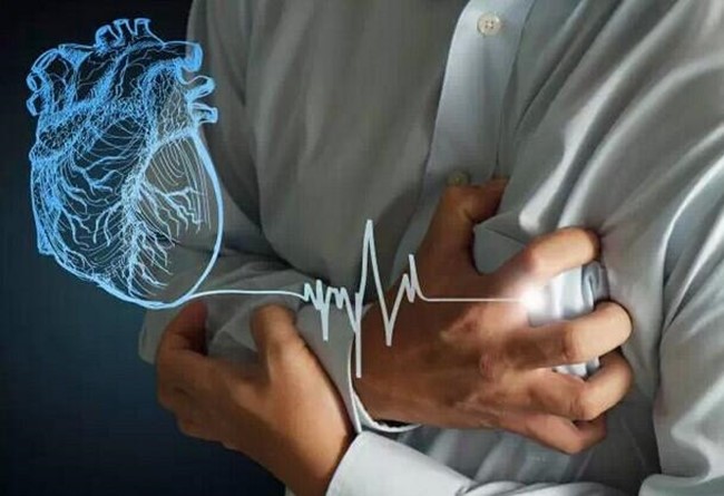 nguyên nhân gây đột tử - ảnh 1