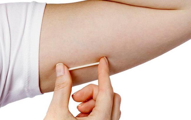 Các biện pháp phòng tránh thai hiệu quả cho vợ chồng son - ảnh 5