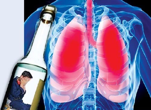 Mỗi cuộc nhậu không kiểm soát đều là ‘đường tắt’ đến ung thư gan - ảnh 1